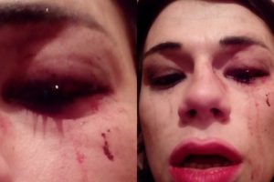 Совершено нападение на трансгендерную женщину в Тбилиси 1.